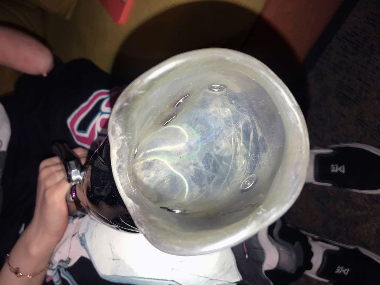 Бионический протез